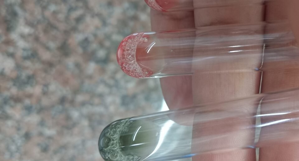 Rh Negative Testing in Action 3 Rh Negative Testing in Action